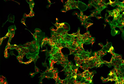 BS-2094 Fluorescenčný efekt- Rakovina prsníka