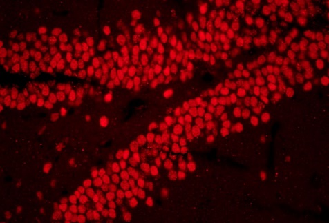 BS-2094 Pangaruh fluoresensi- Hippocampus