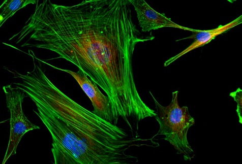 BS-2094 Effet fluorescent - Cellules nerveuses du cerveau de souris