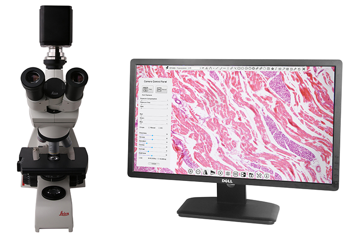 BWHC-4k mikroskop+display