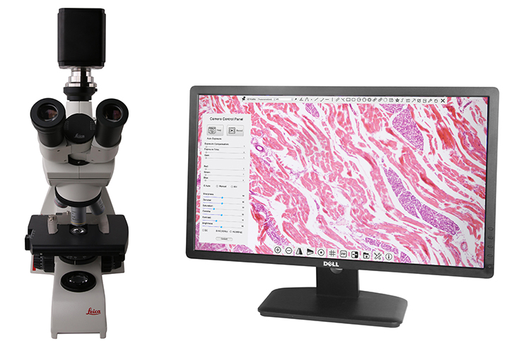 BWHC-4k Microscope+ Nuni