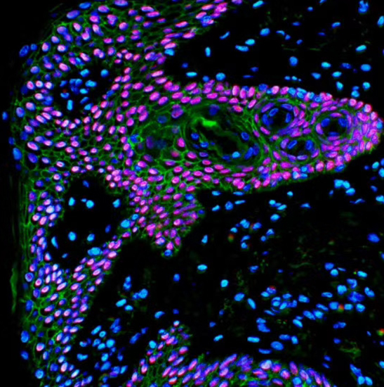 Epidermisgewebe