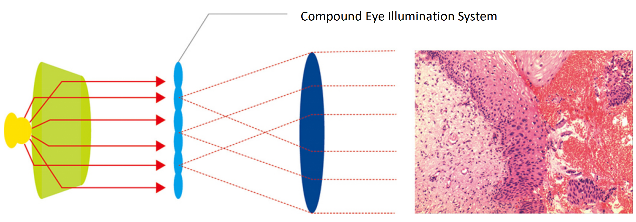 BS-2043 Compound Eye Illumination System